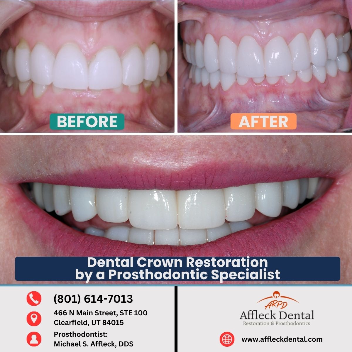 Nancy N. before and after photo