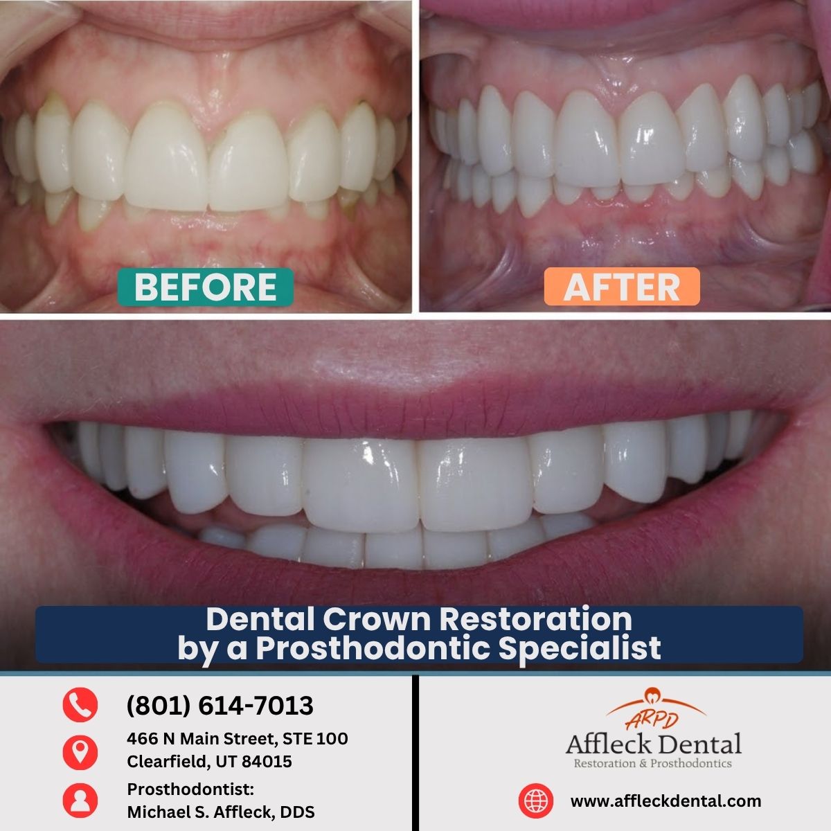 Nancy N. before and after image